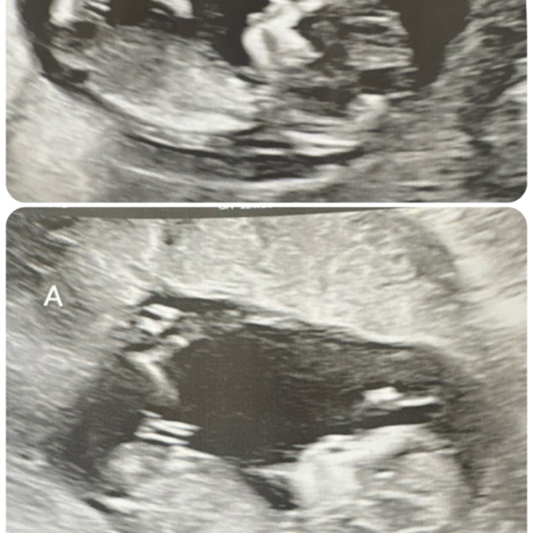 Photo shared by Jada for their Babylist baby registry.