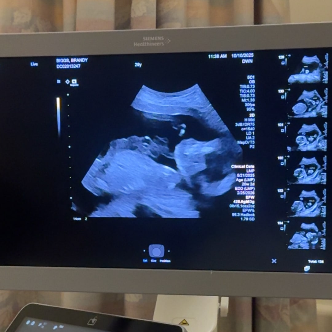 Photo shared by Brandy for their Babylist baby registry.