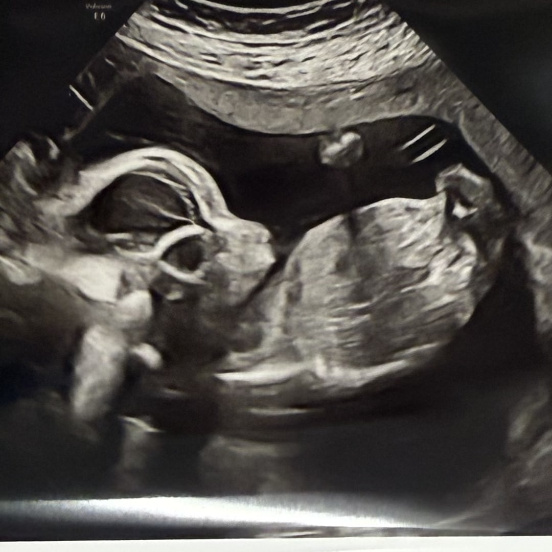 Photo shared by Cathleen for their Babylist baby registry.