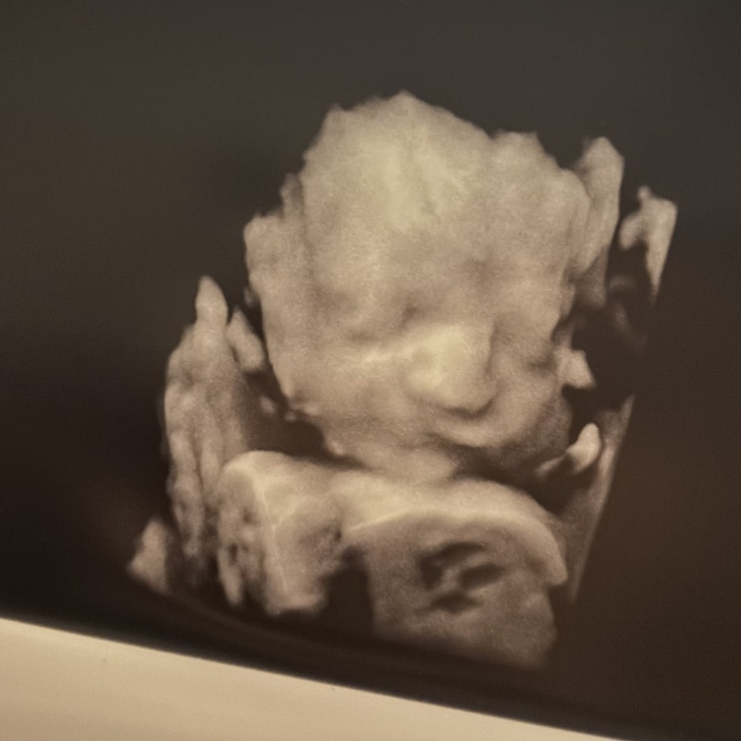 Photo shared by Denize for their Babylist baby registry.