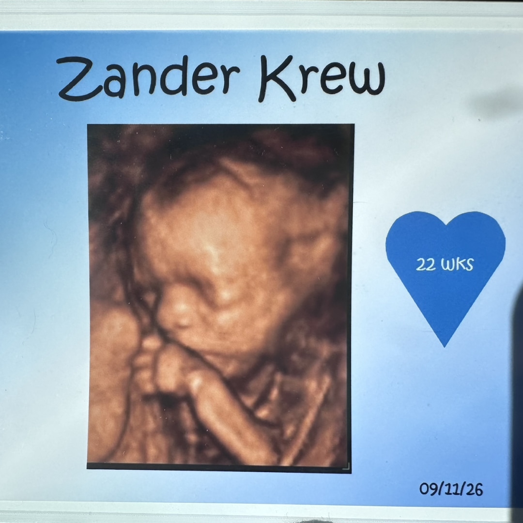 Photo shared by Amber for their Babylist baby registry.