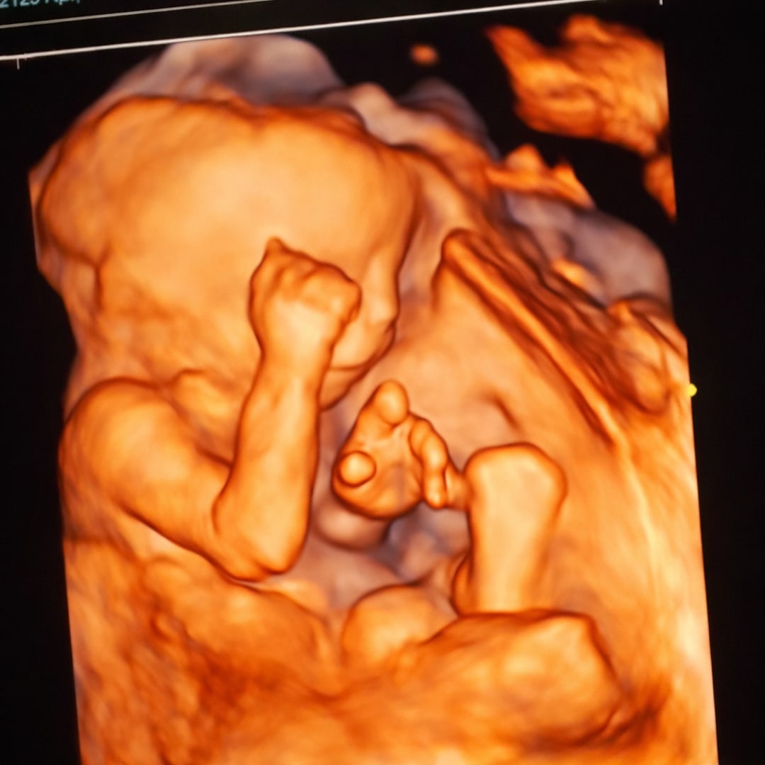 Photo shared by Amy for their Babylist baby registry.