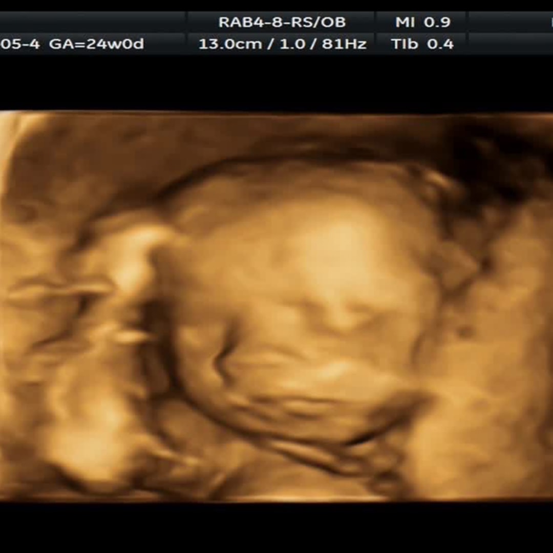 Photo shared by Tina for their Babylist baby registry.