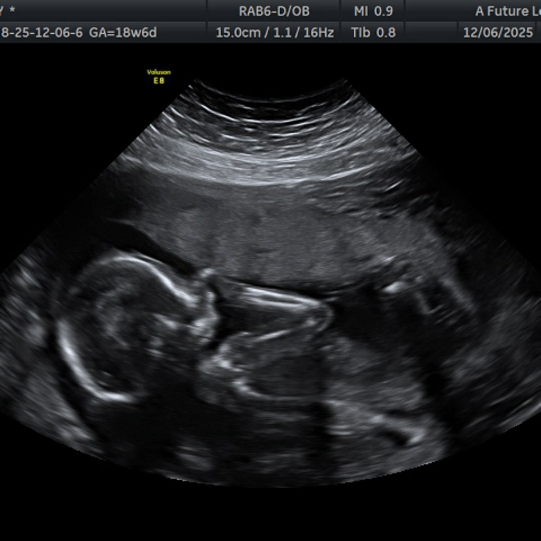 Photo shared by Emily for their Babylist baby registry.