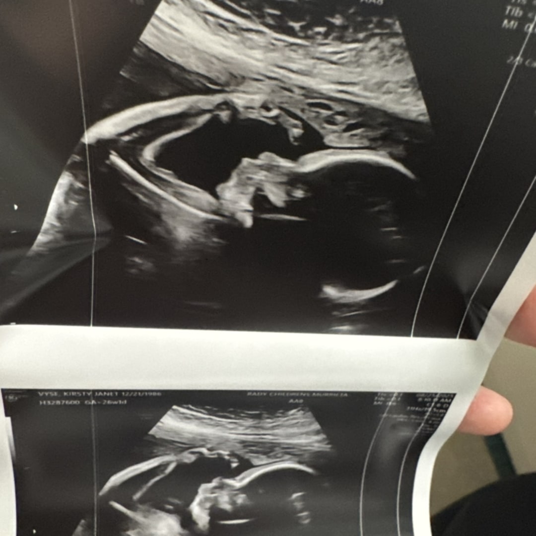 Photo shared by Kirsty for their Babylist baby registry.