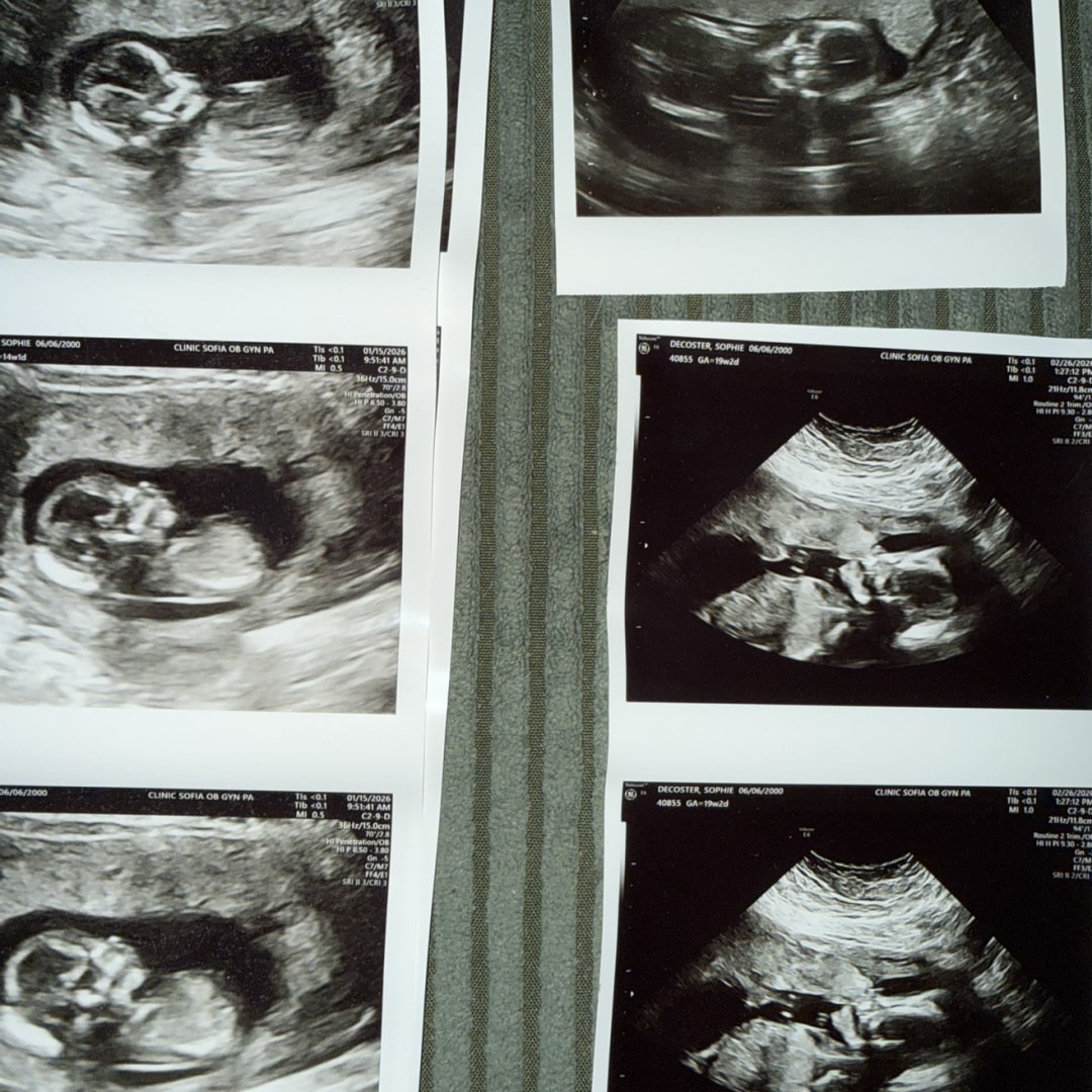 Photo shared by Sophie for their Babylist baby registry.