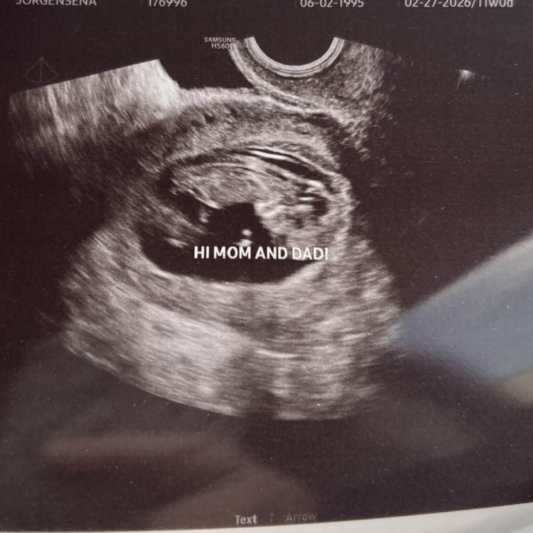 Photo shared by Kelsey for their Babylist baby registry.