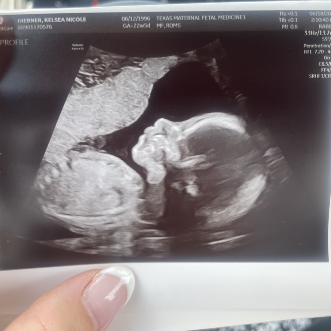 Photo shared by Kelsea for their Babylist baby registry.