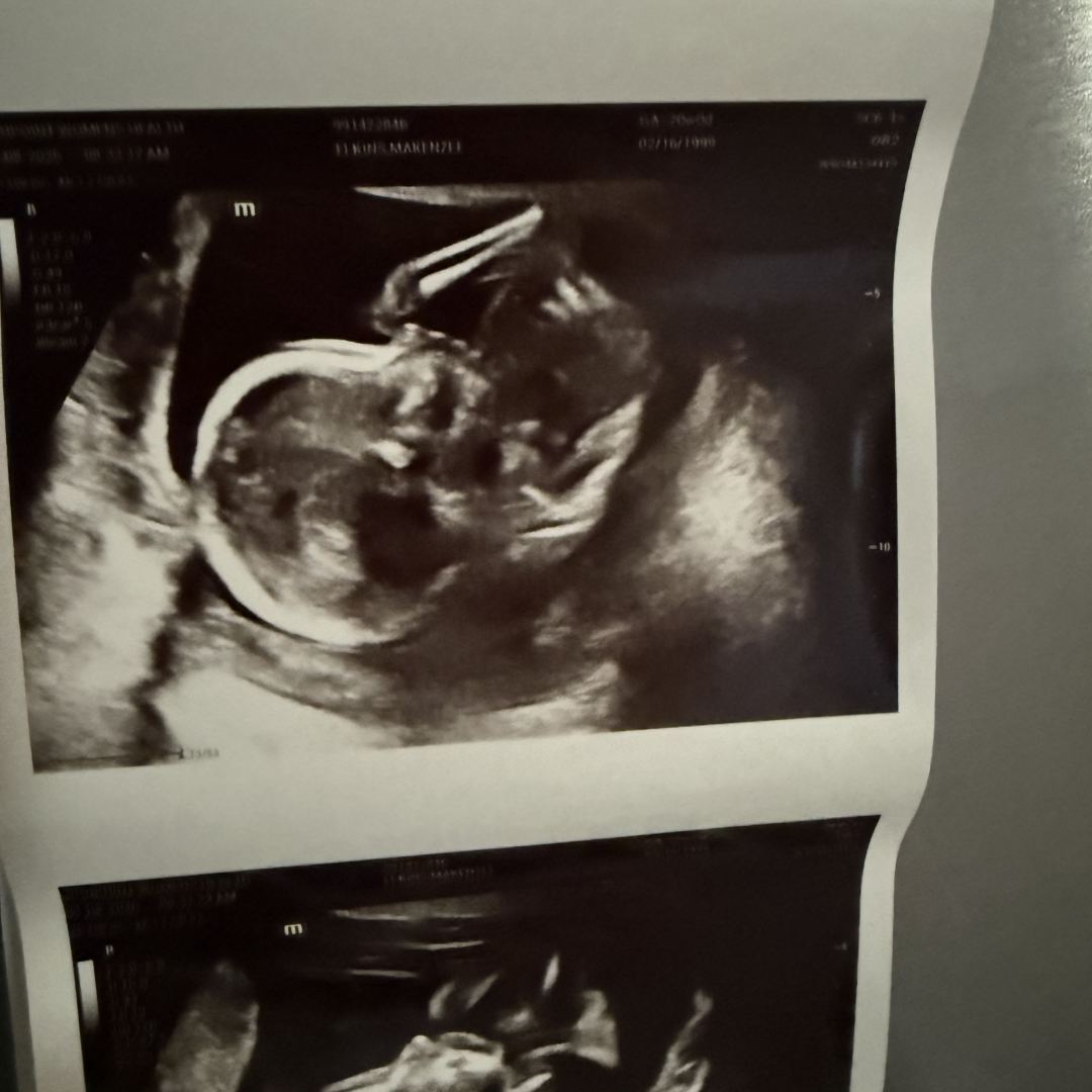 Photo shared by Makenzee for their Babylist baby registry.