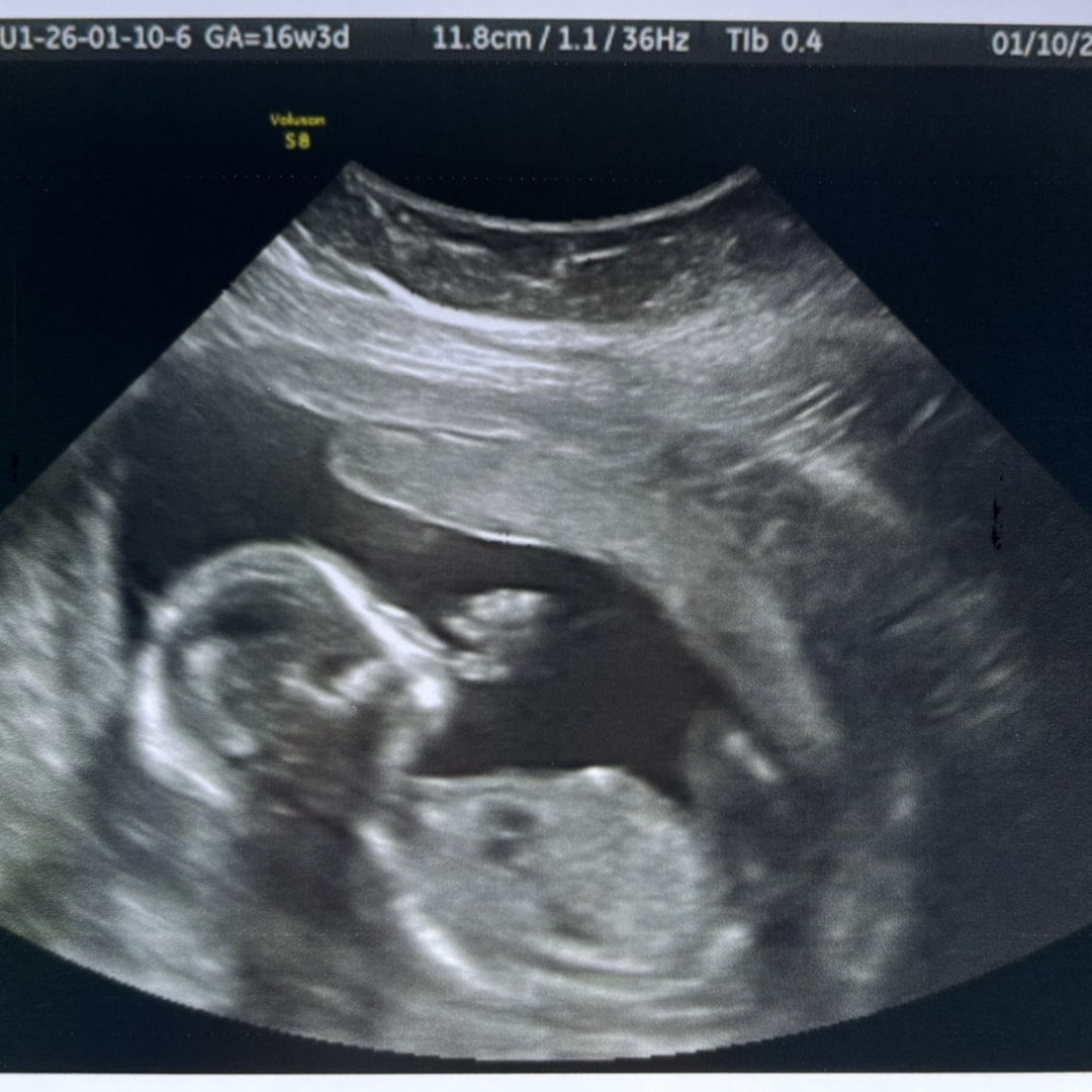 Photo shared by Lina for their Babylist baby registry.