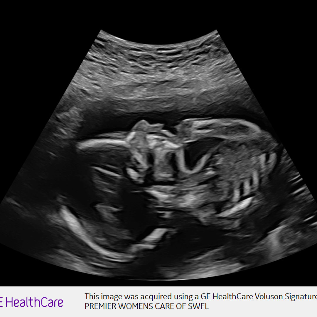 Photo shared by Toni for their Babylist baby registry.