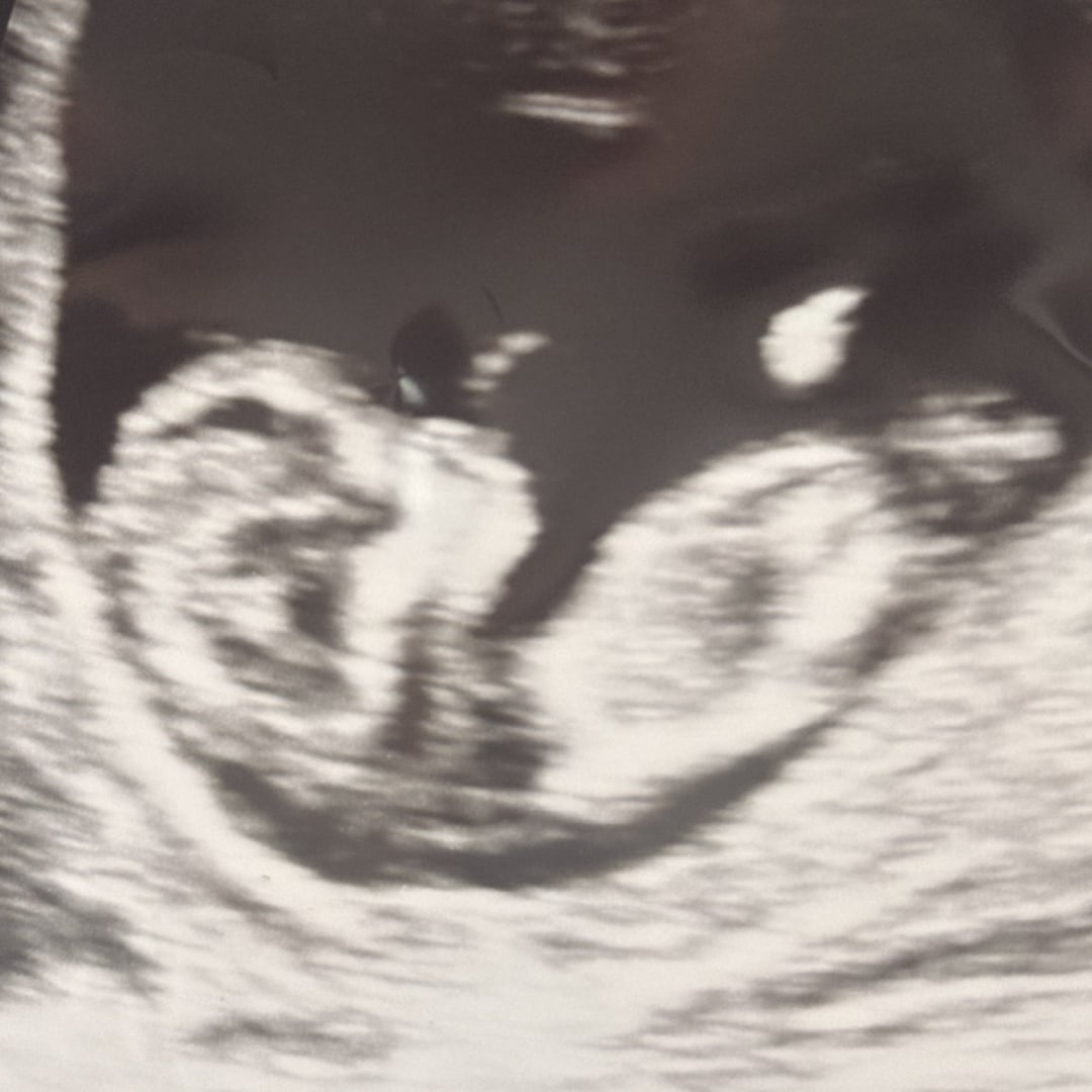 Photo shared by Abygayle for their Babylist baby registry.