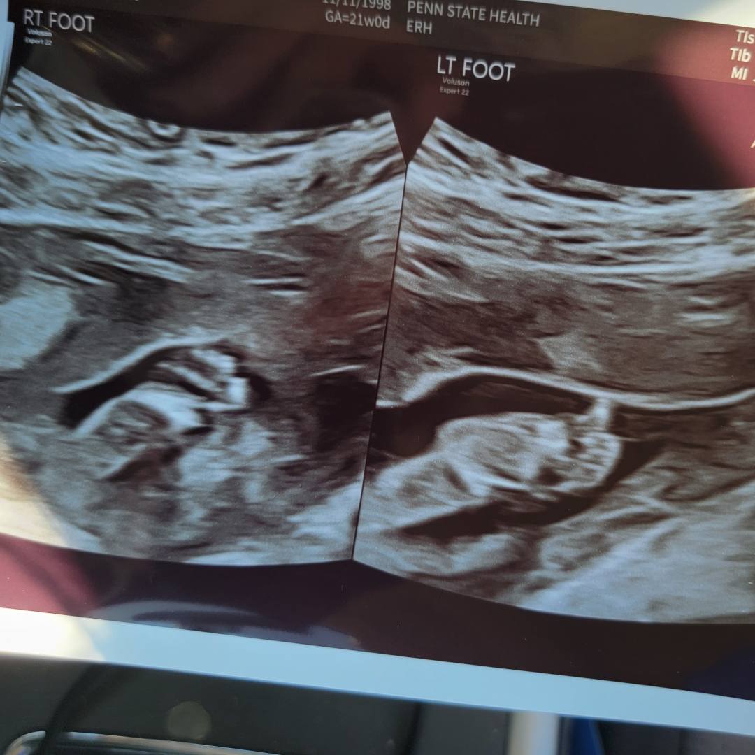 Photo shared by Marissa for their Babylist baby registry.