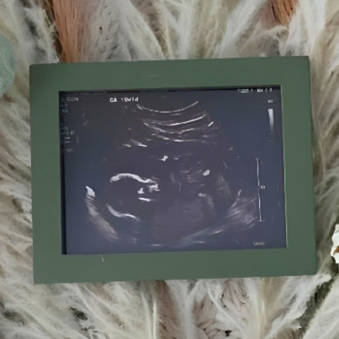 Photo shared by Desiree for their Babylist baby registry.