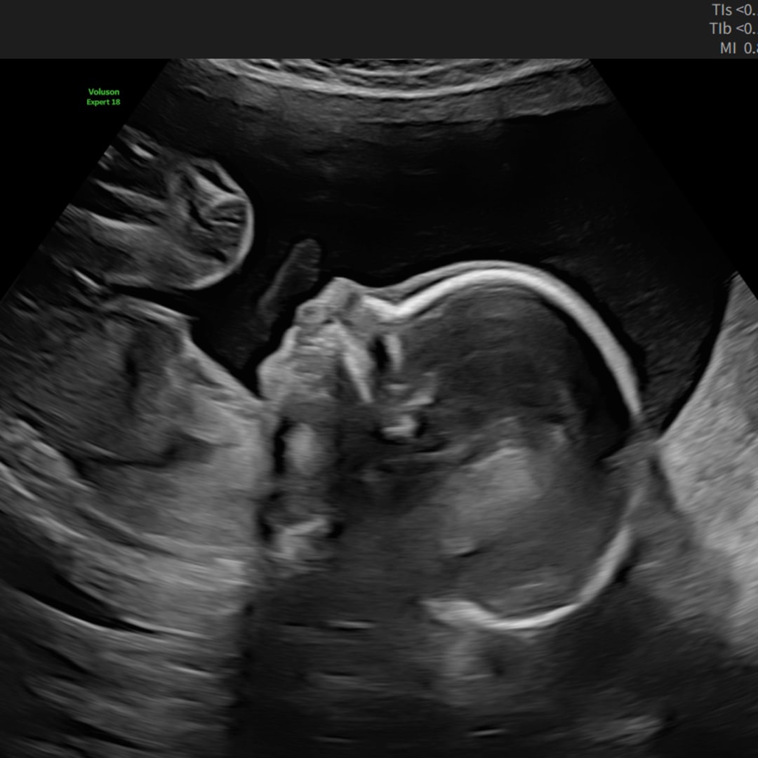 Photo shared by Claire for their Babylist baby registry.