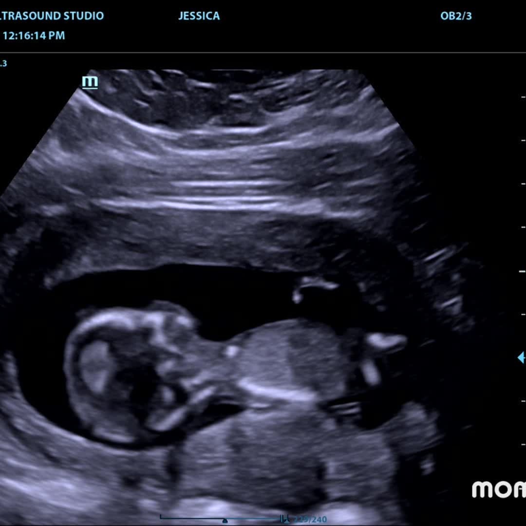 Photo shared by Jessica for their Babylist baby registry.