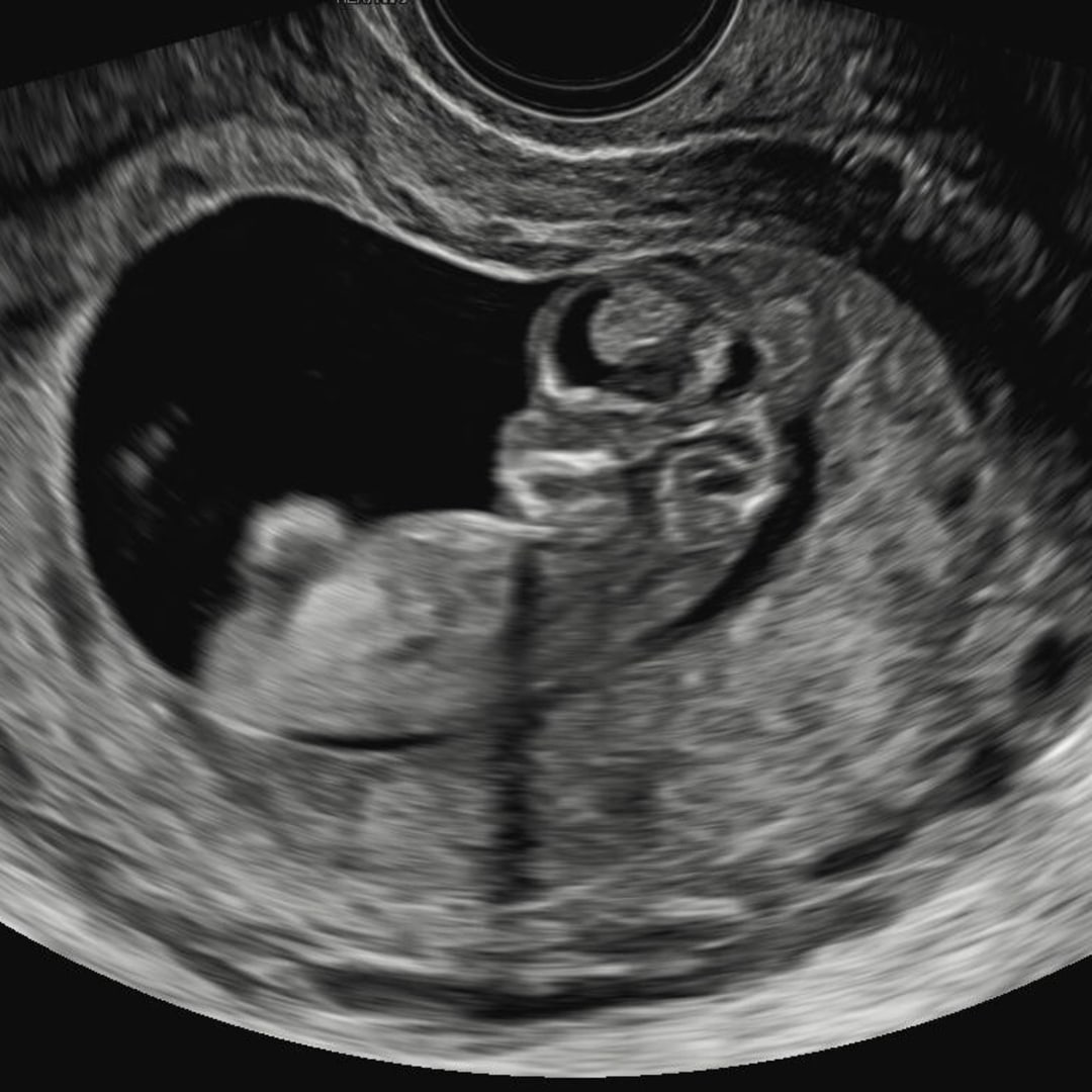 Photo shared by Gabby for their Babylist baby registry.