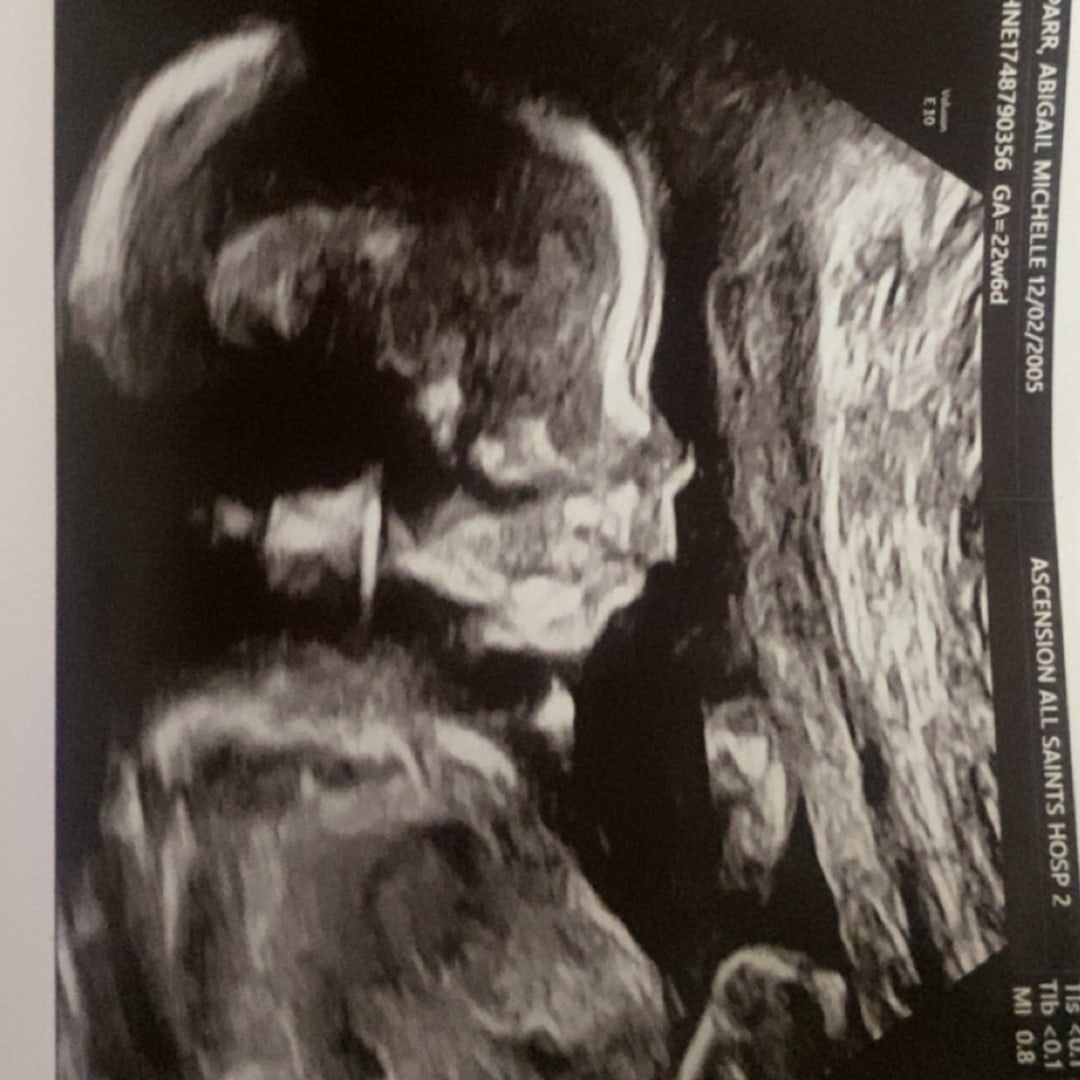 Photo shared by Abiannaa for their Babylist baby registry.