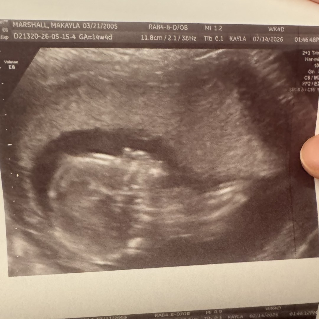 Photo shared by Makayla for their Babylist baby registry.