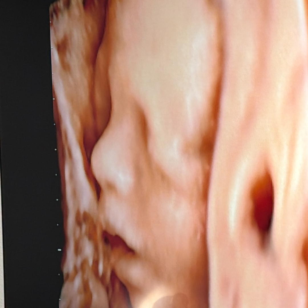 Photo shared by Alexa for their Babylist baby registry.