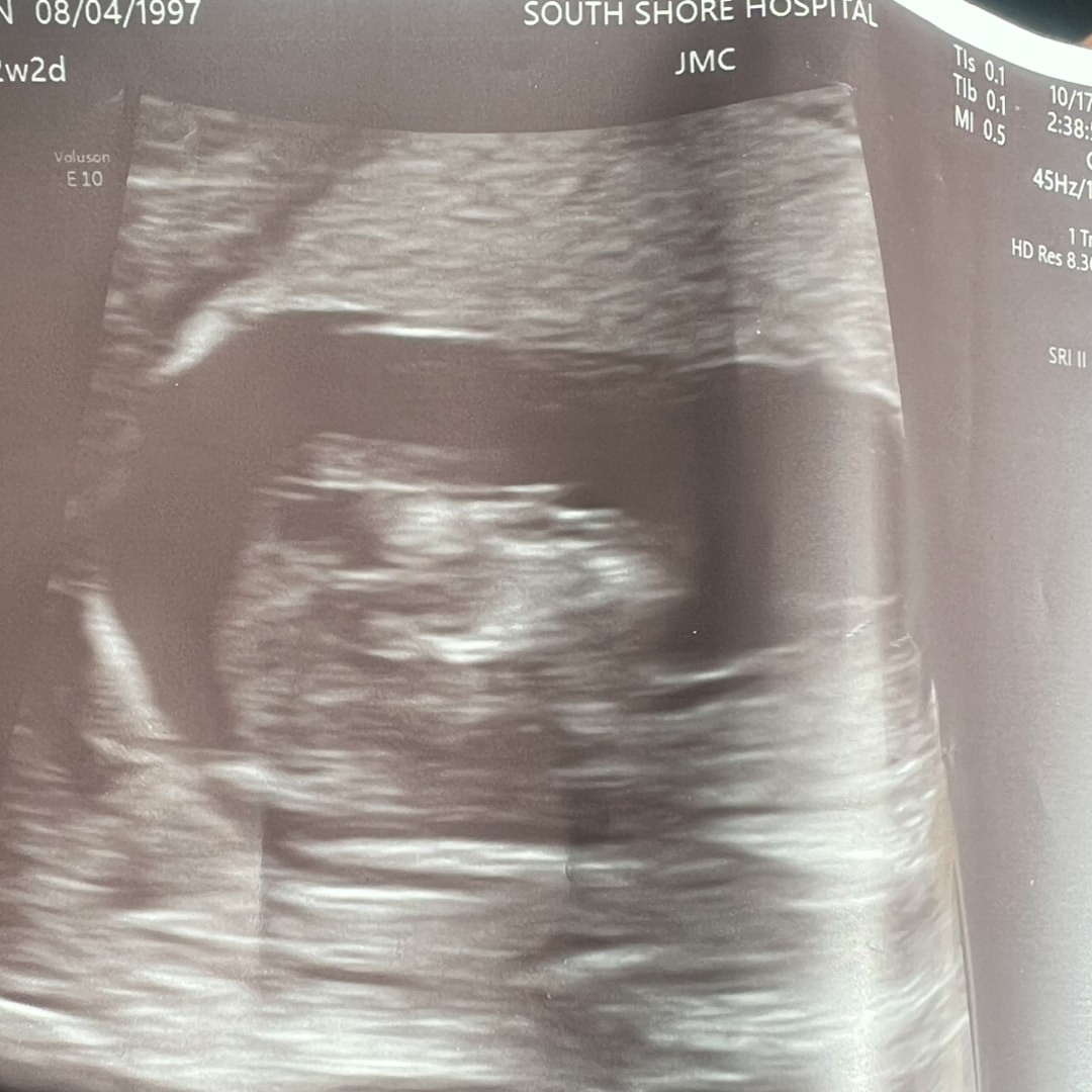 Photo shared by Stanleen for their Babylist baby registry.