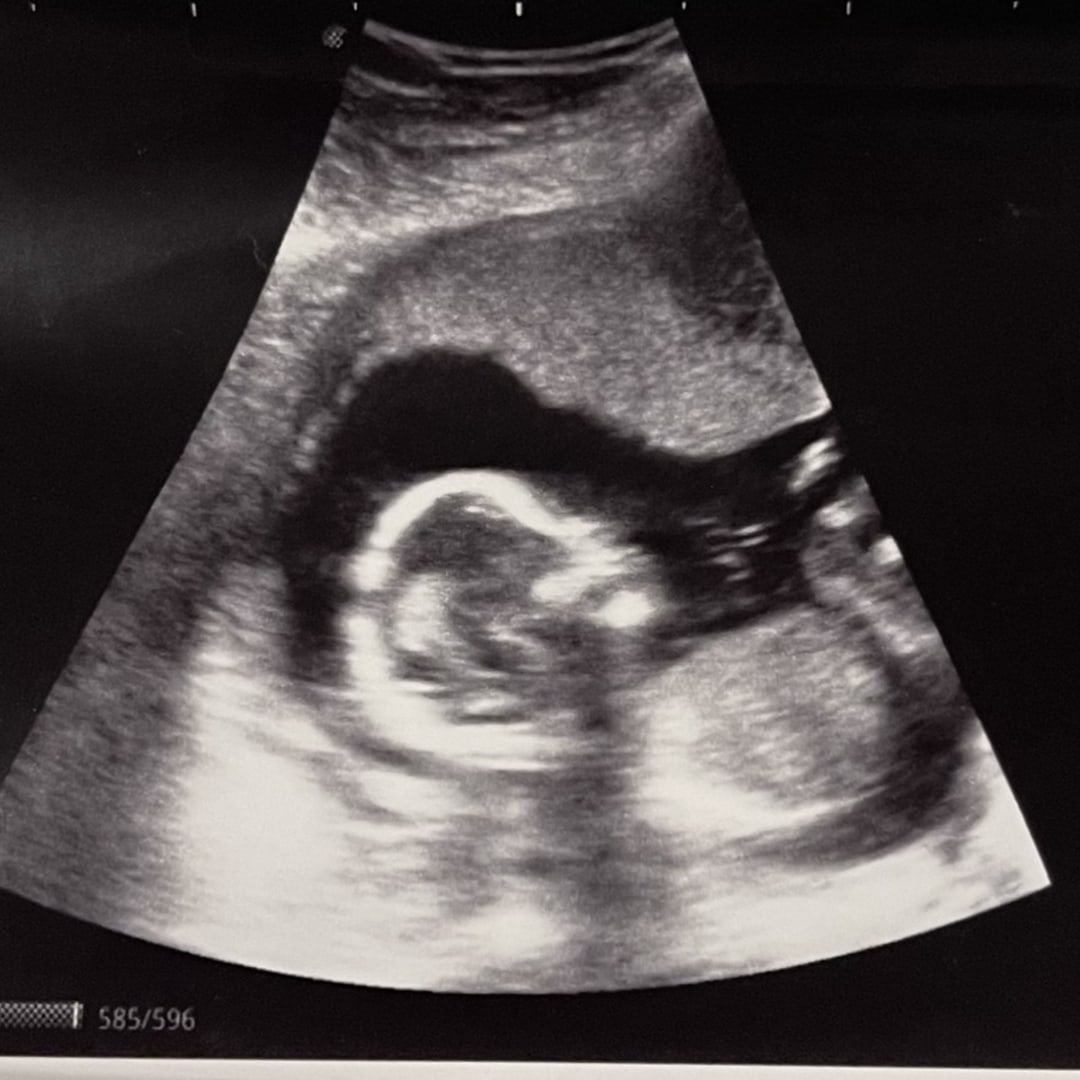 Photo shared by Karis for their Babylist baby registry.