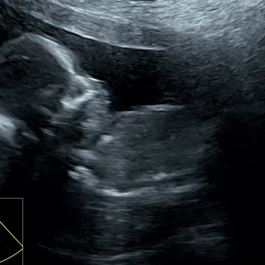 Photo shared by Janet for their Babylist baby registry.