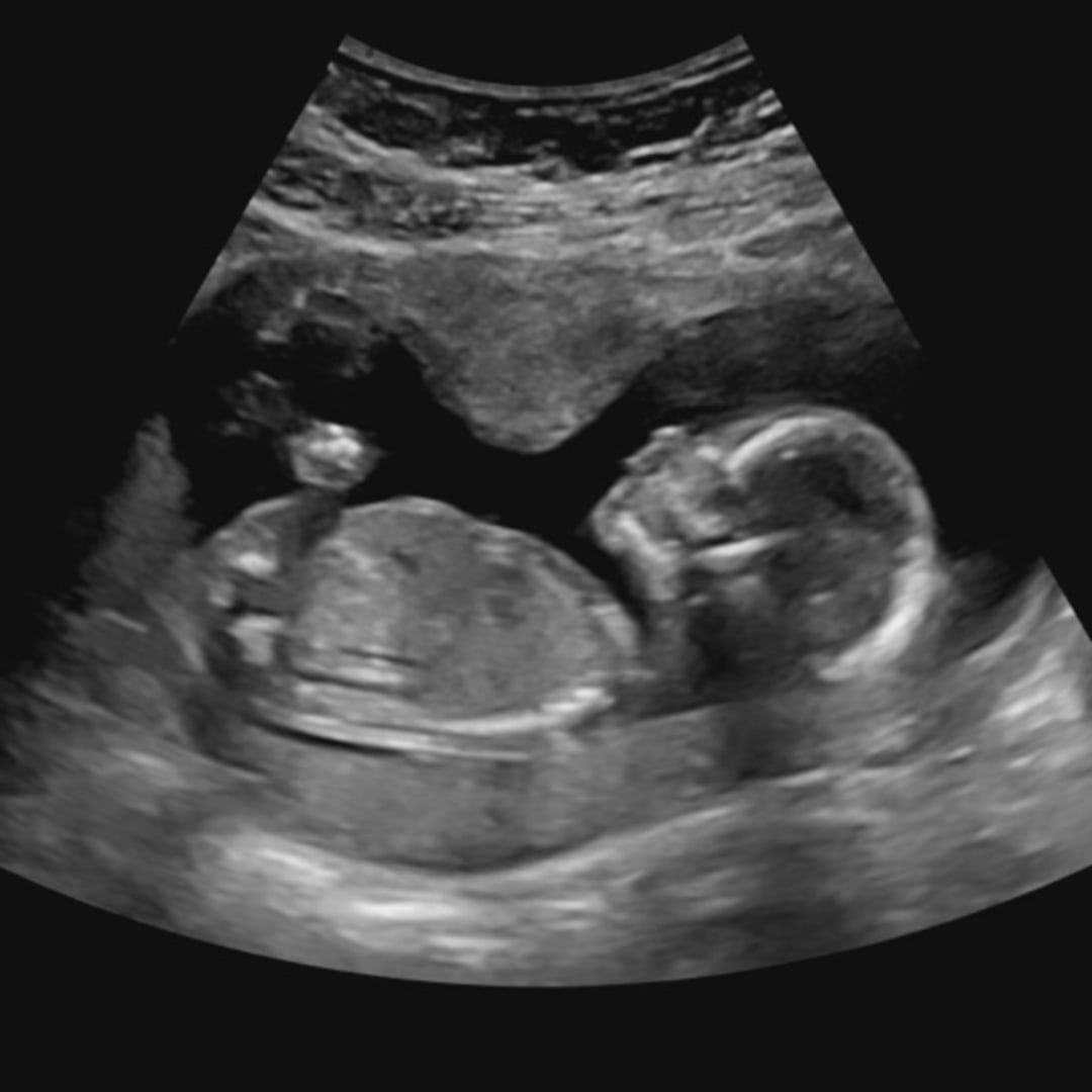 Photo shared by Bailey for their Babylist baby registry.