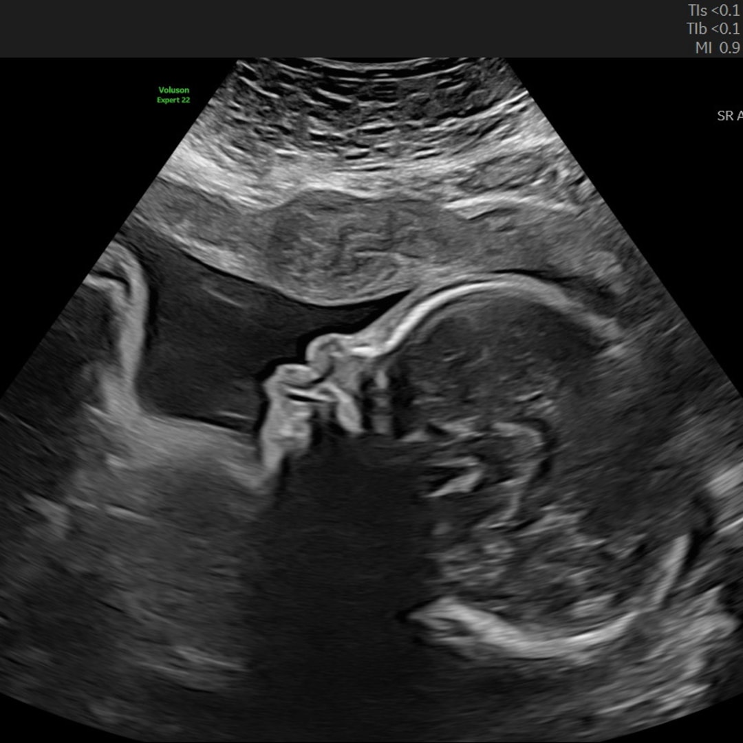 Photo shared by Catherine for their Babylist baby registry.