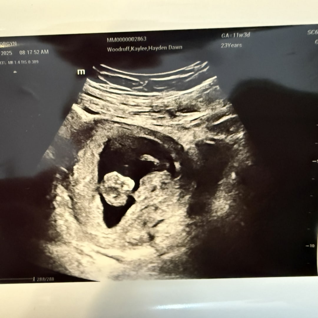 Photo shared by Kaylee for their Babylist baby registry.