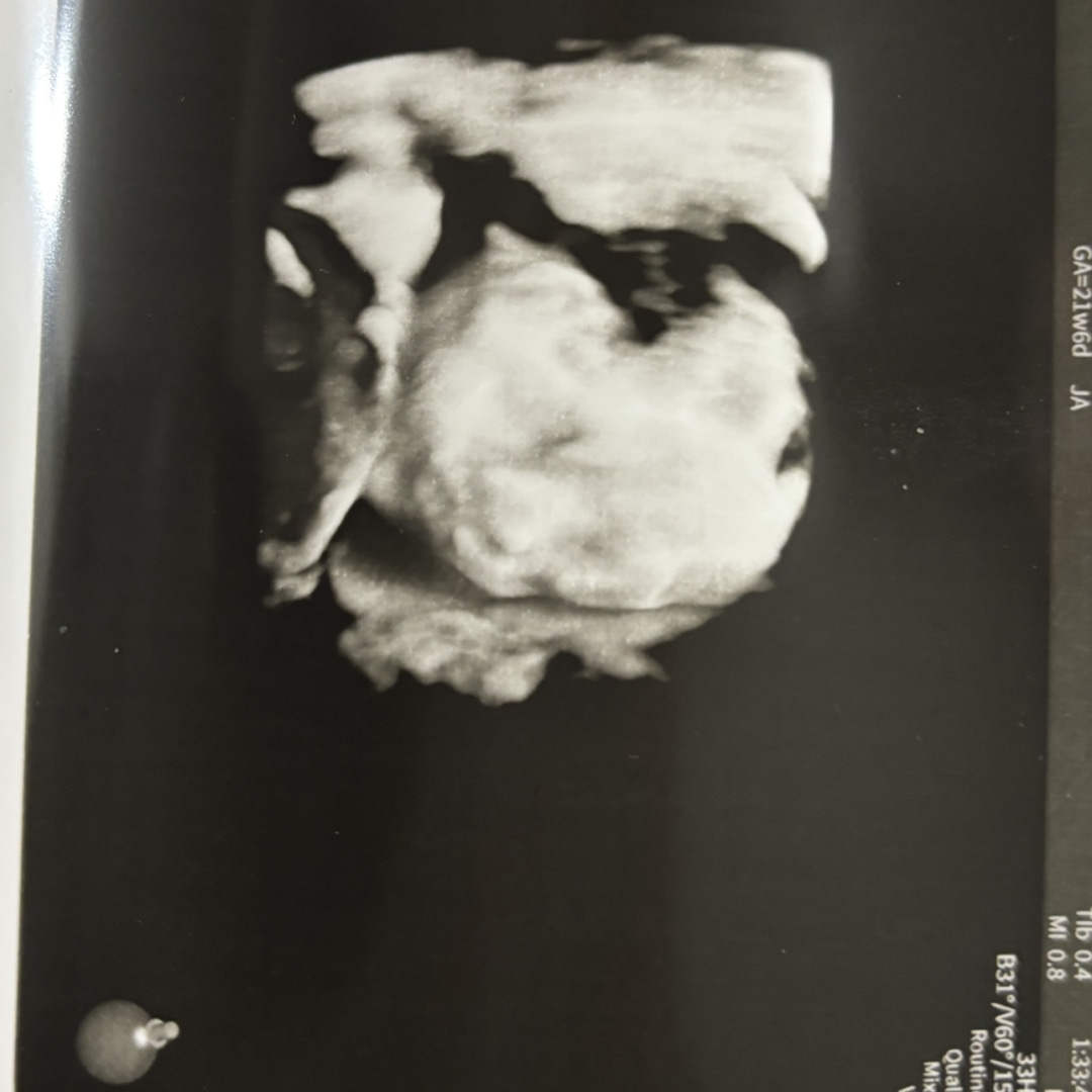 Photo shared by Victoria for their Babylist baby registry.