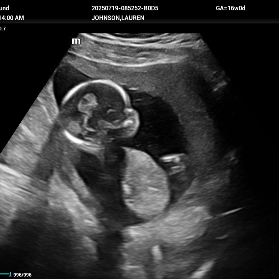 Photo shared by Lauren for their Babylist baby registry.
