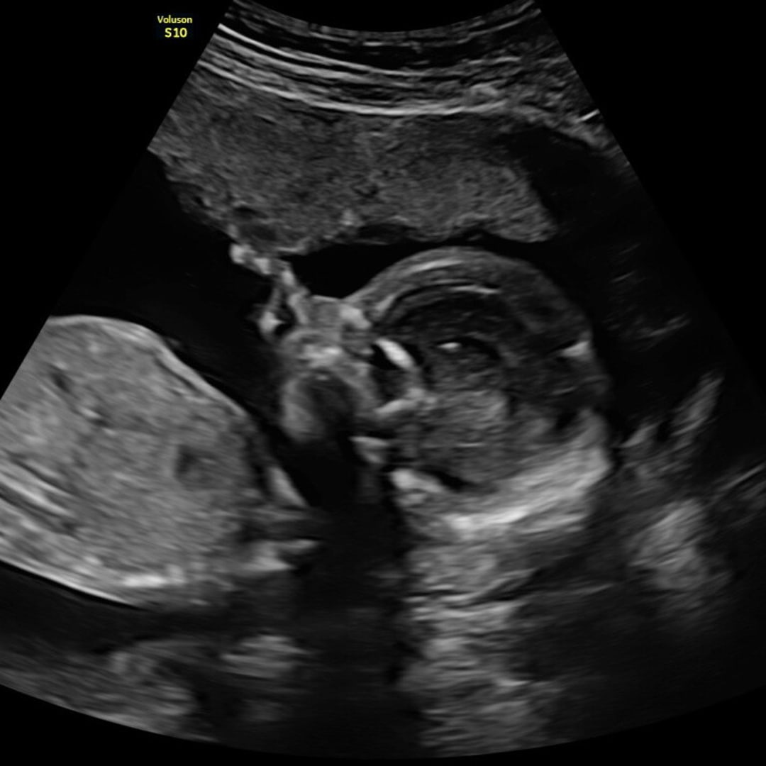 Photo shared by Carleigh for their Babylist baby registry.
