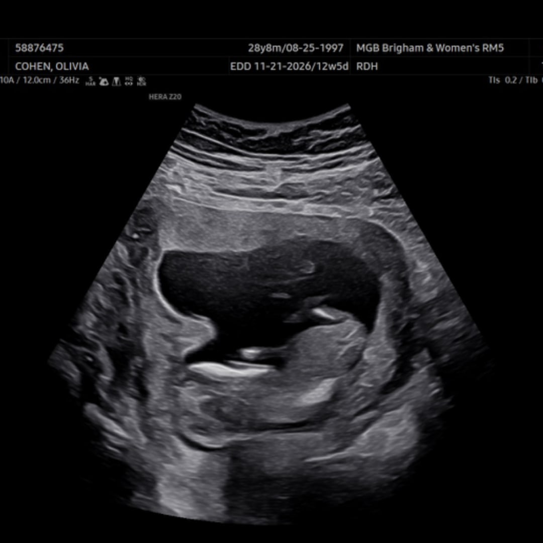 Photo shared by Olivia for their Babylist baby registry.