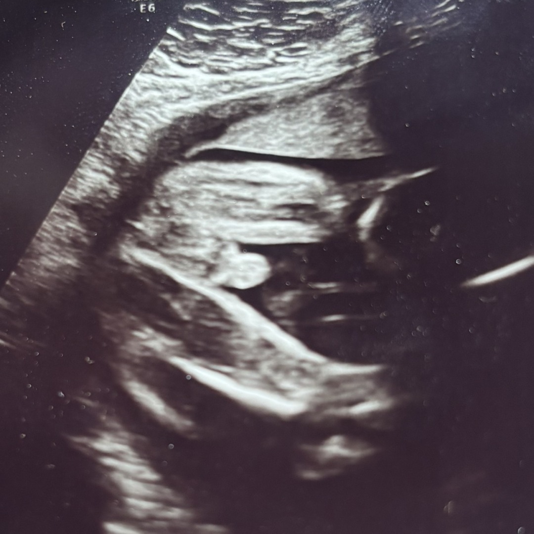 Photo shared by Keana for their Babylist baby registry.
