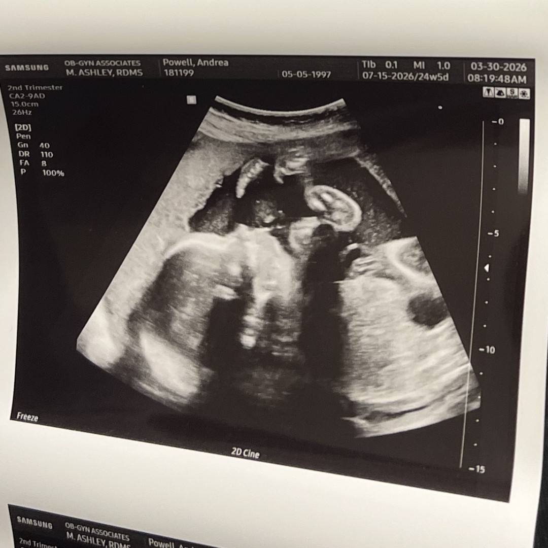 Photo shared by Andrea for their Babylist baby registry.
