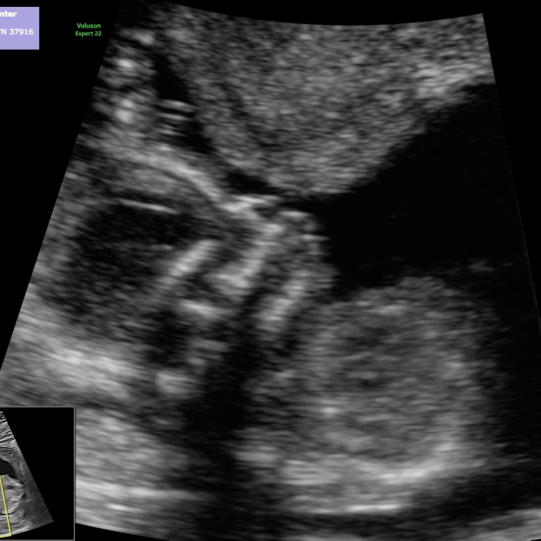 Photo shared by Aliyson for their Babylist baby registry.