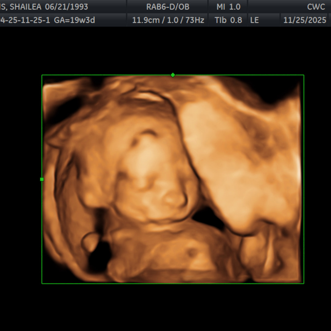 Photo shared by Shailea for their Babylist baby registry.