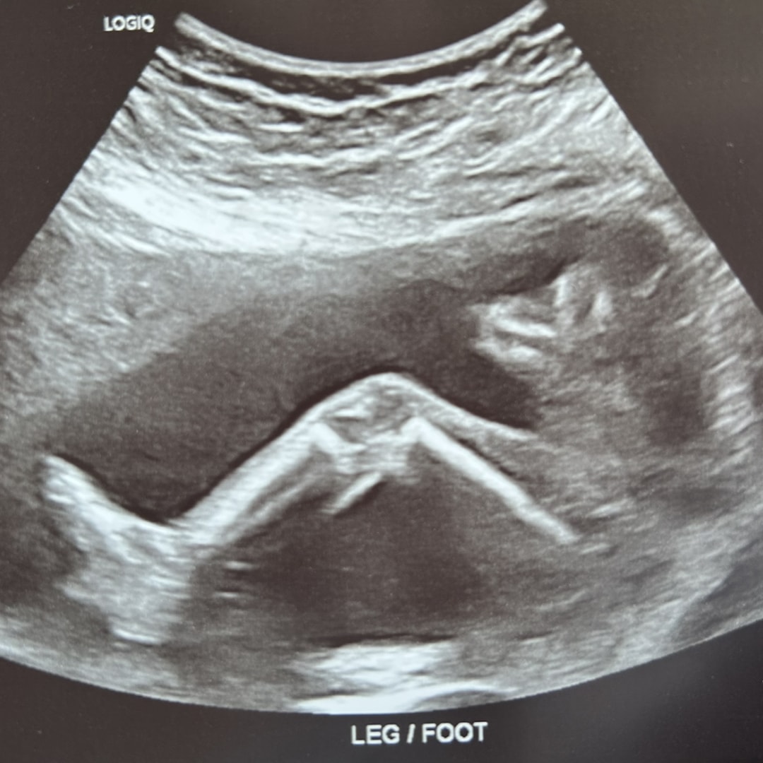 Photo shared by Kate for their Babylist baby registry.