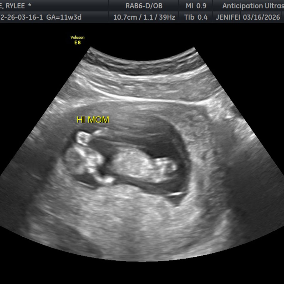 Photo shared by Rylee for their Babylist baby registry.