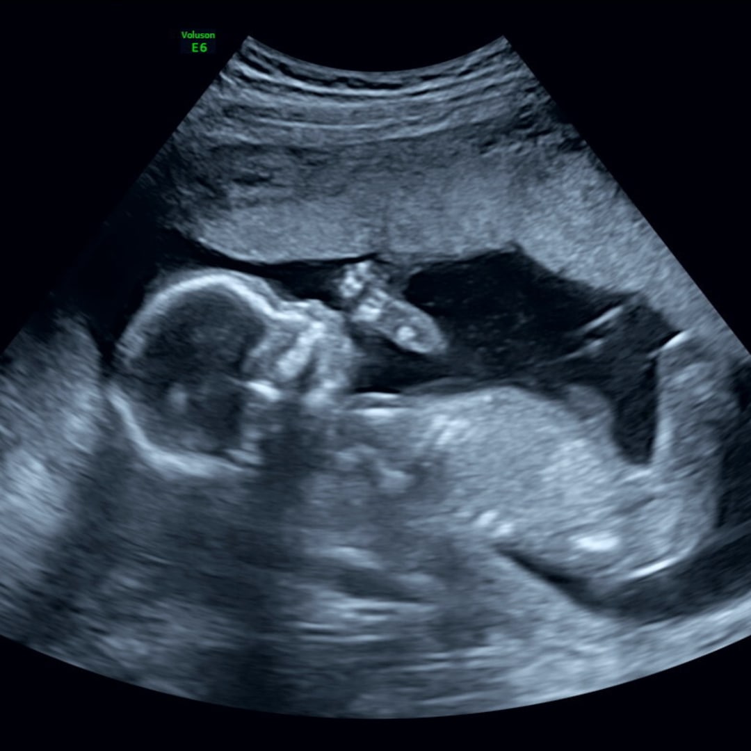 Photo shared by Elizabeth for their Babylist baby registry.