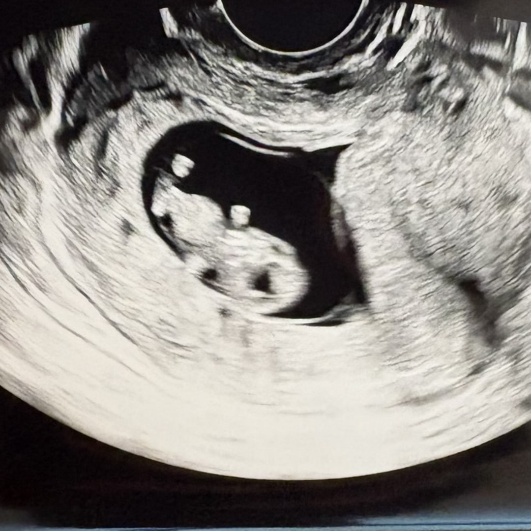 Photo shared by Danielle for their Babylist baby registry.