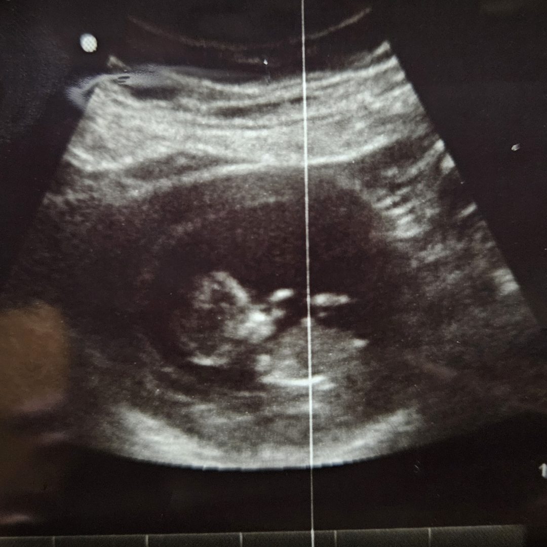 Photo shared by Amanda for their Babylist baby registry.