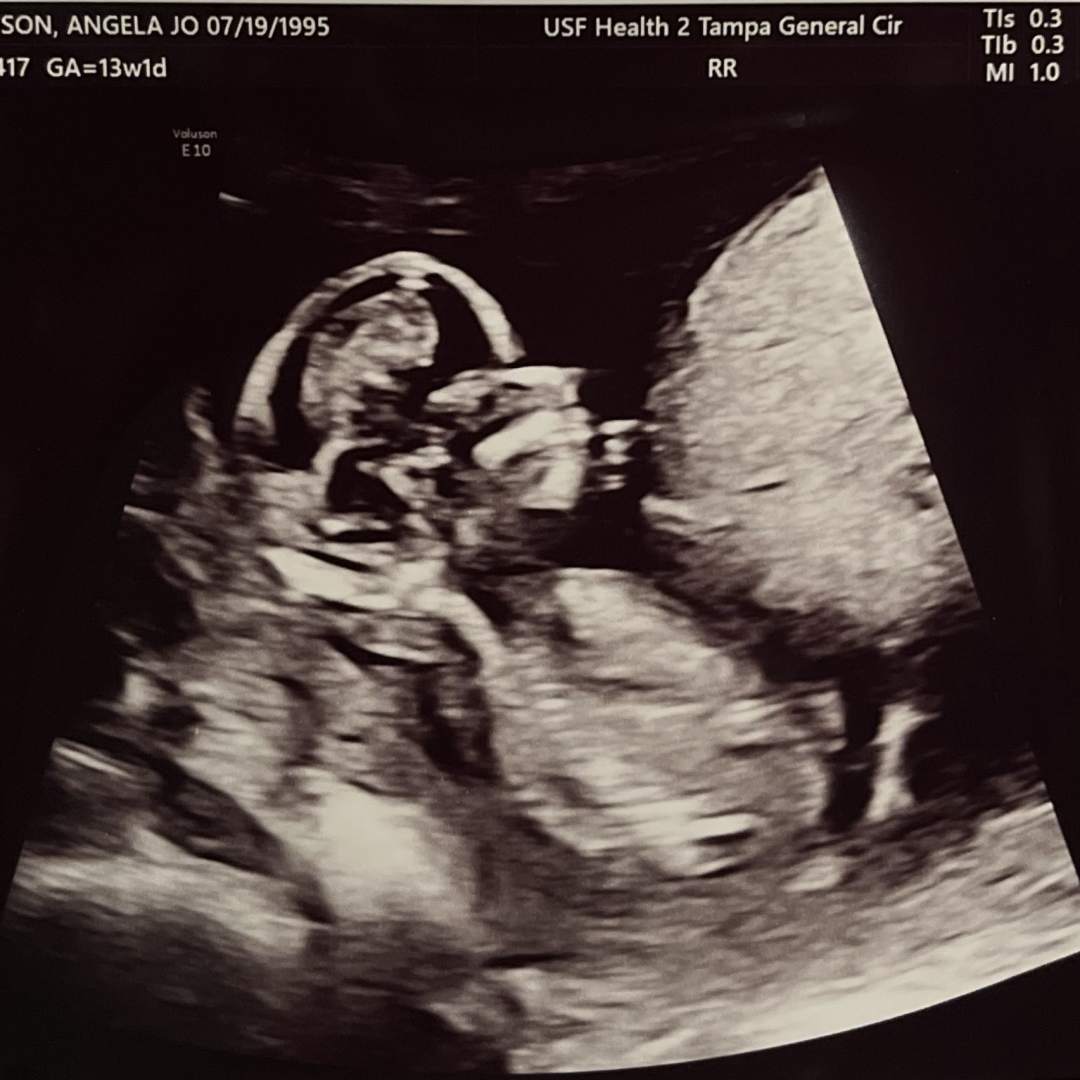 Photo shared by Angela & Ben for their Babylist baby registry.