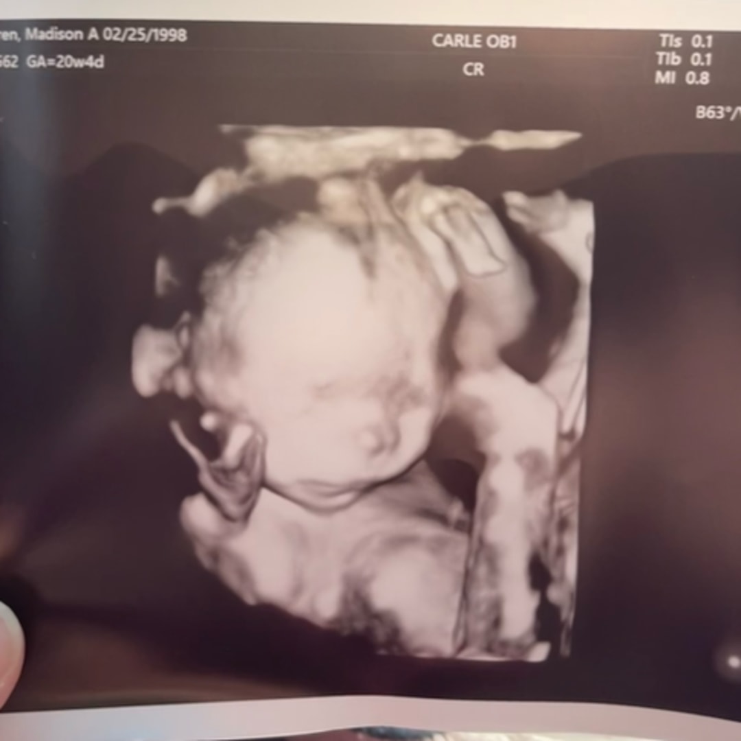 Photo shared by Madison for their Babylist baby registry.