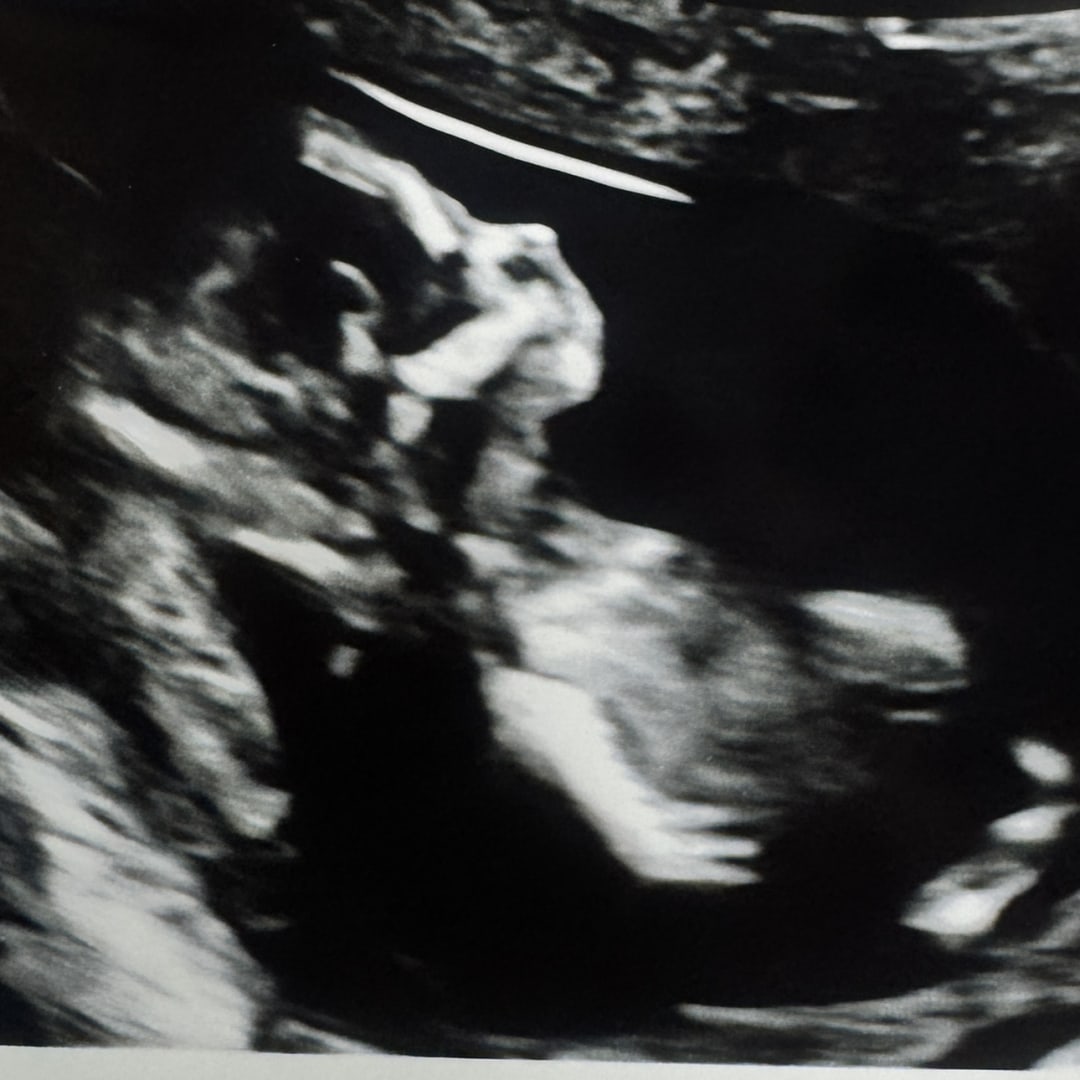 Photo shared by Kyra for their Babylist baby registry.