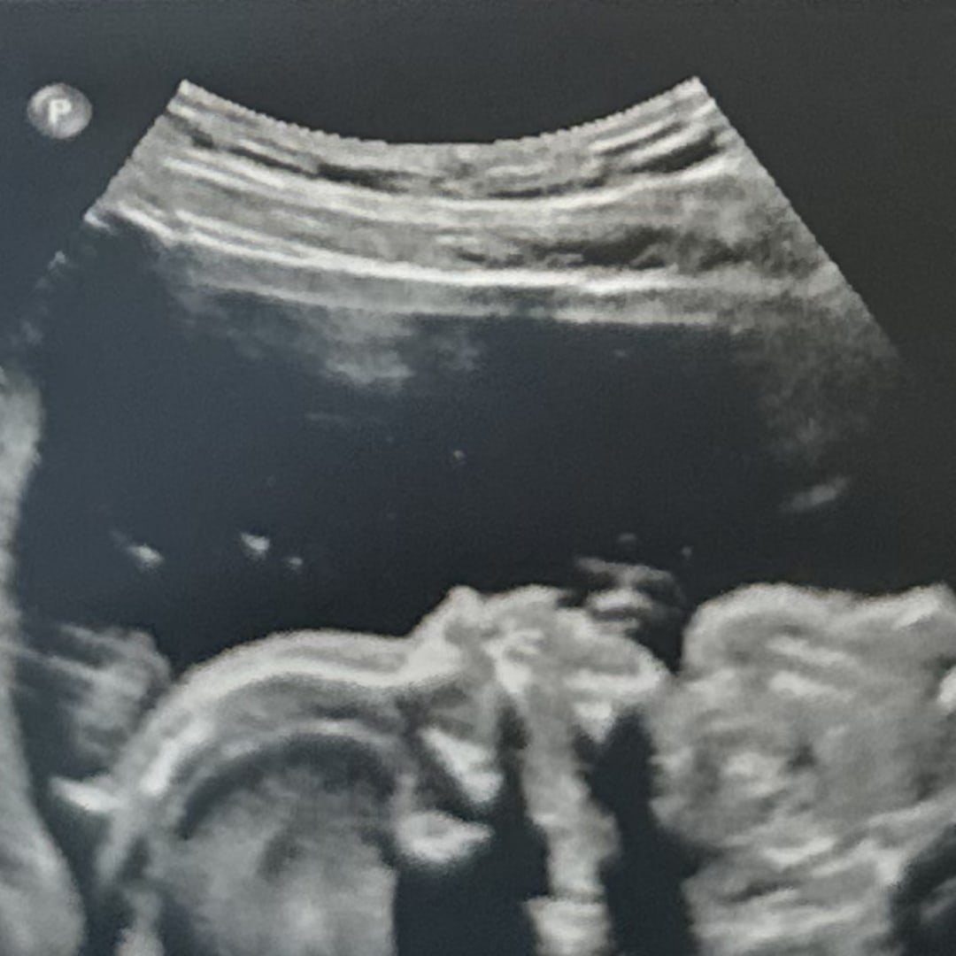 Photo shared by Kyra for their Babylist baby registry.