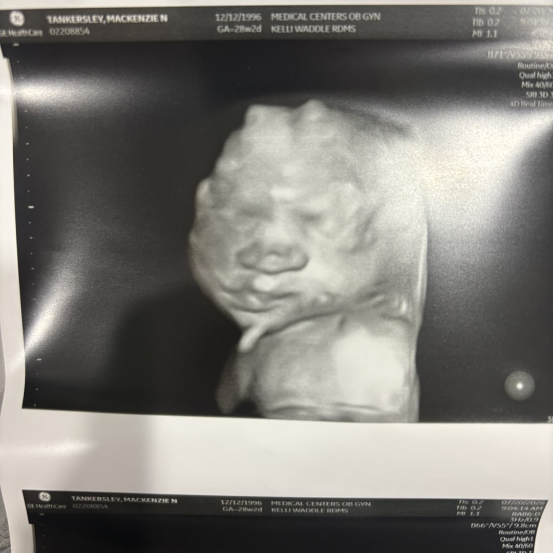 Photo shared by Mackenzie for their Babylist baby registry.