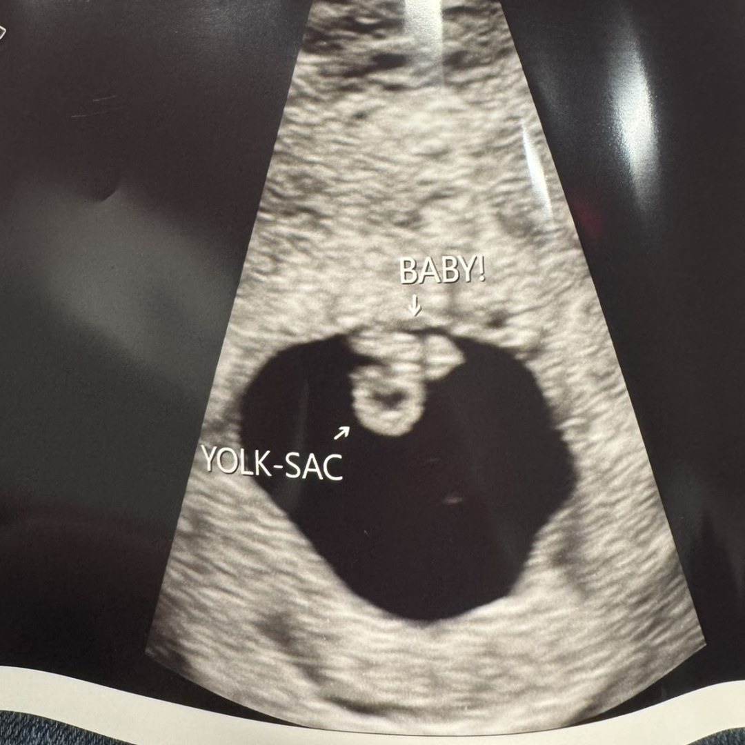 Photo shared by Katelyn for their Babylist baby registry.