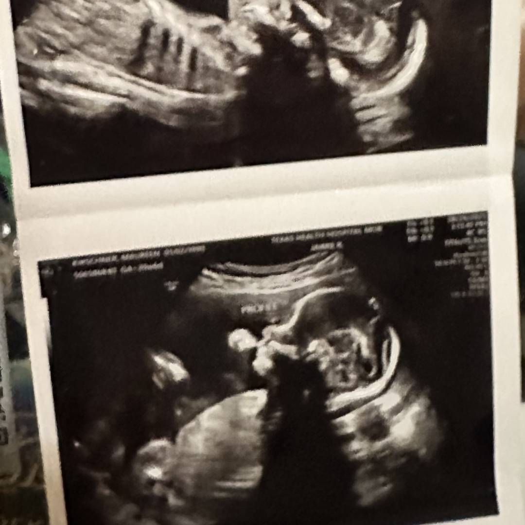 Photo shared by Ashley for their Babylist baby registry.